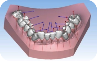 Set-up virtuali con segmentazioni dei denti